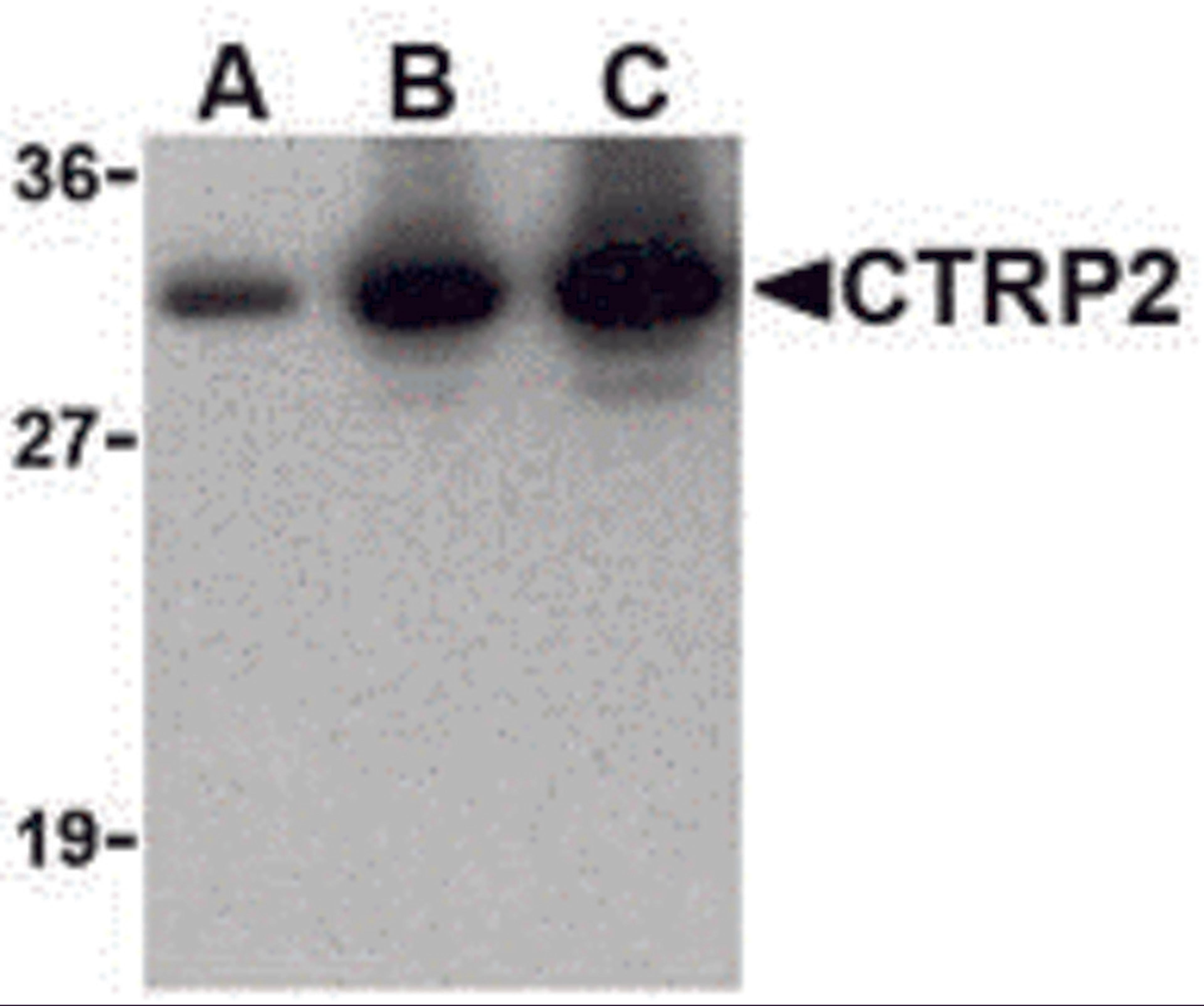 Western blot of recombinant CTRP2: (A) 5 ng, (B) 25 ng, and (C) 50 ng with CTRP2 at 1 μg/mL.