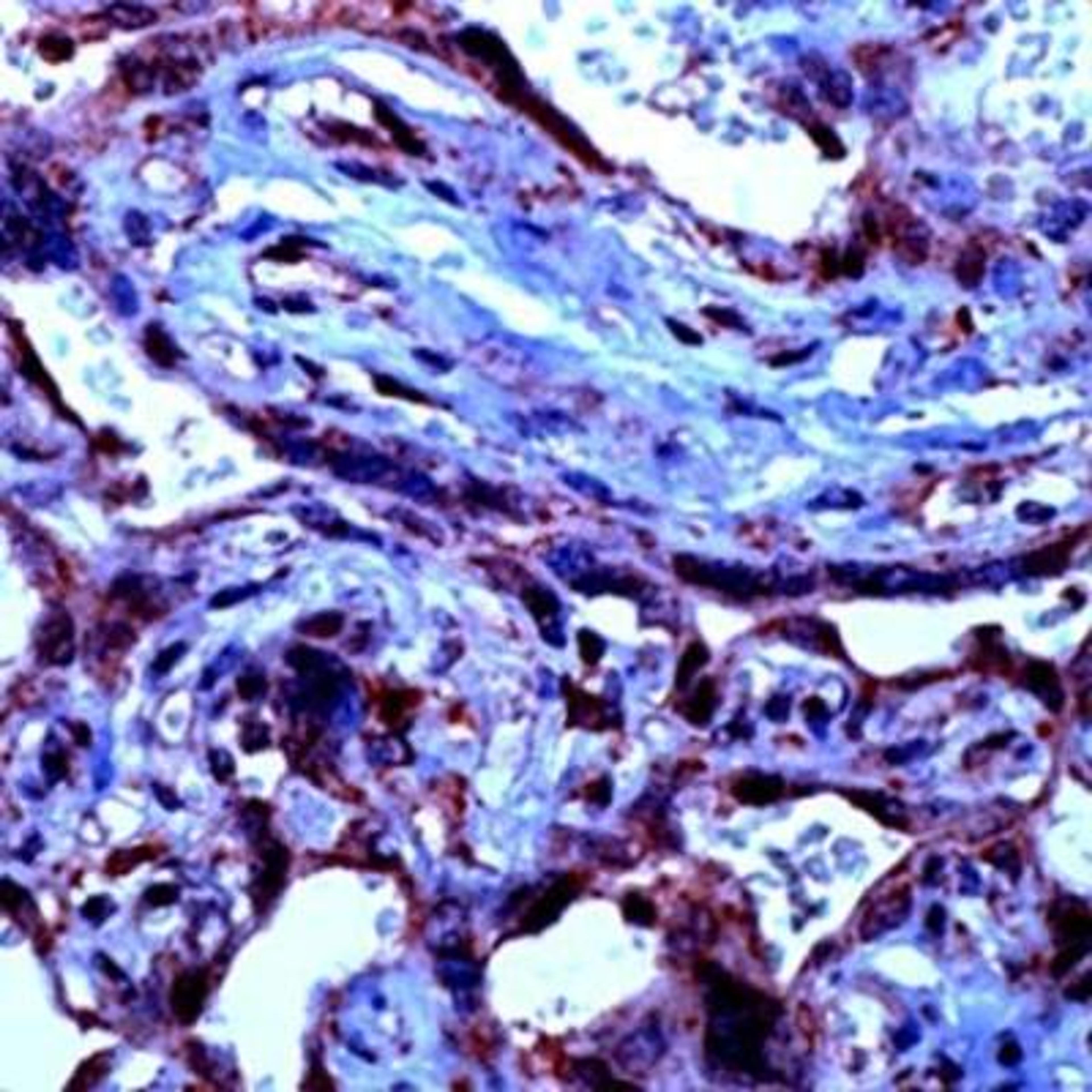 Immunohistochemistry-Paraffin: TGF-beta 3 Antibody [NB600-1531] - Formalin fixed paraffin embedded human placenta stained with TGFb3 antibody.