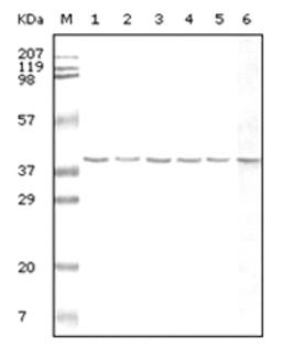 Western blot analysis of GAPDH using Hela, K562, Jurkat, NIH / 3T3, HepG2 cell lysate, and human stomach carcinoma tissue lysate .