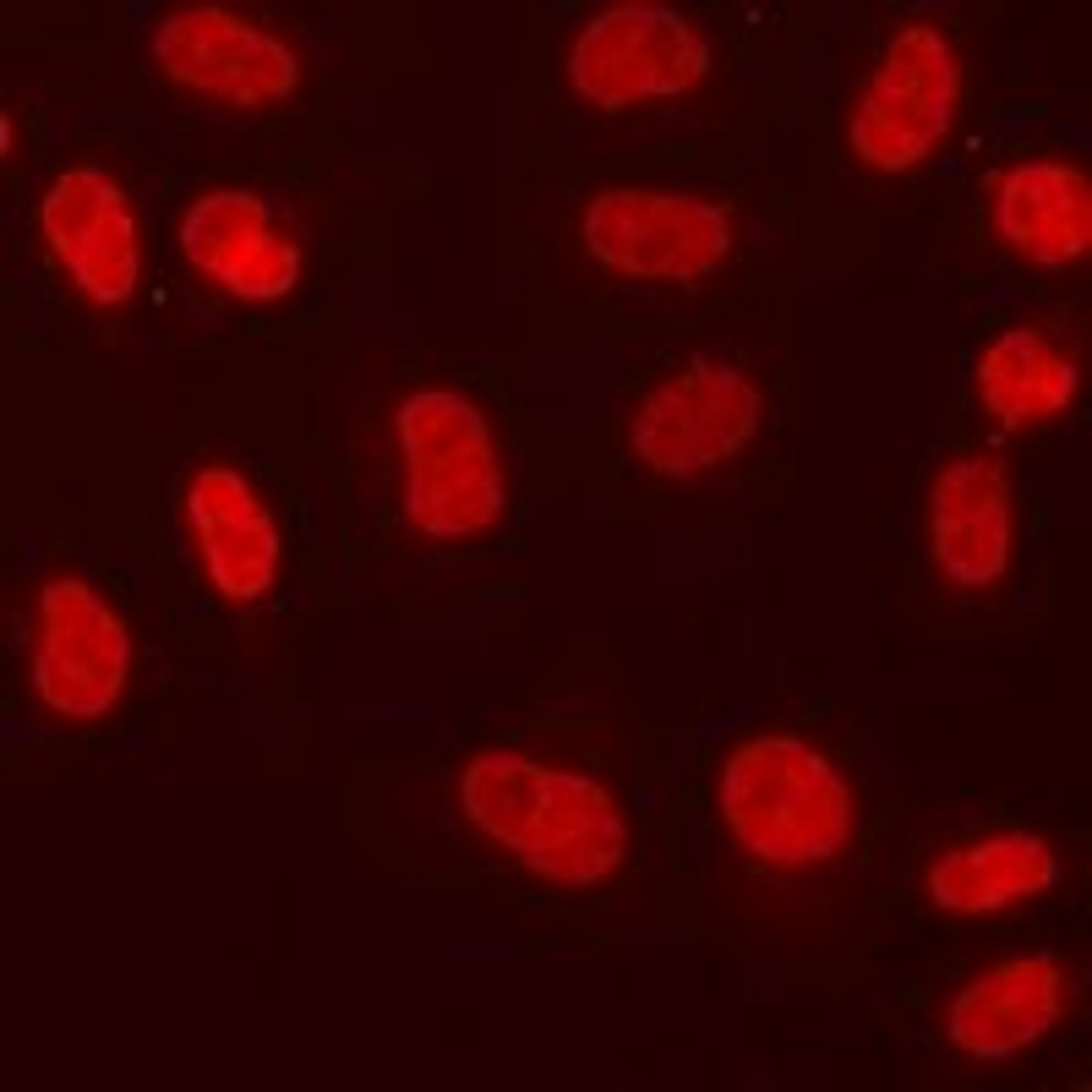 Immunofluorescent analysis of MCF7 cells using REST antibody