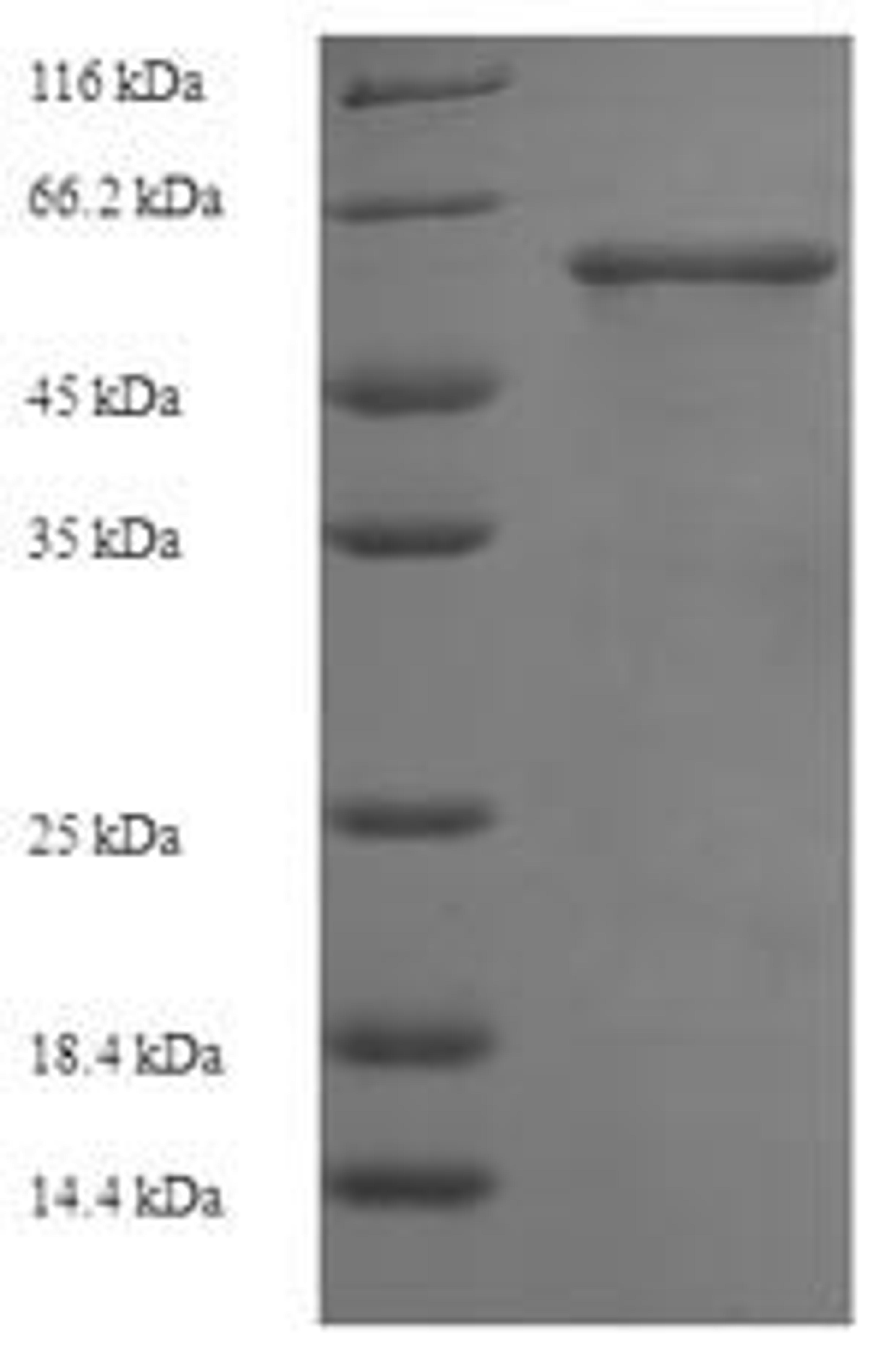 (Tris-Glycine gel) Discontinuous SDS-PAGE (reduced) with 5% enrichment gel and 15% separation gel.