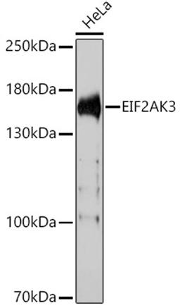 Western blot - EIF2AK3 antibody (A18196)