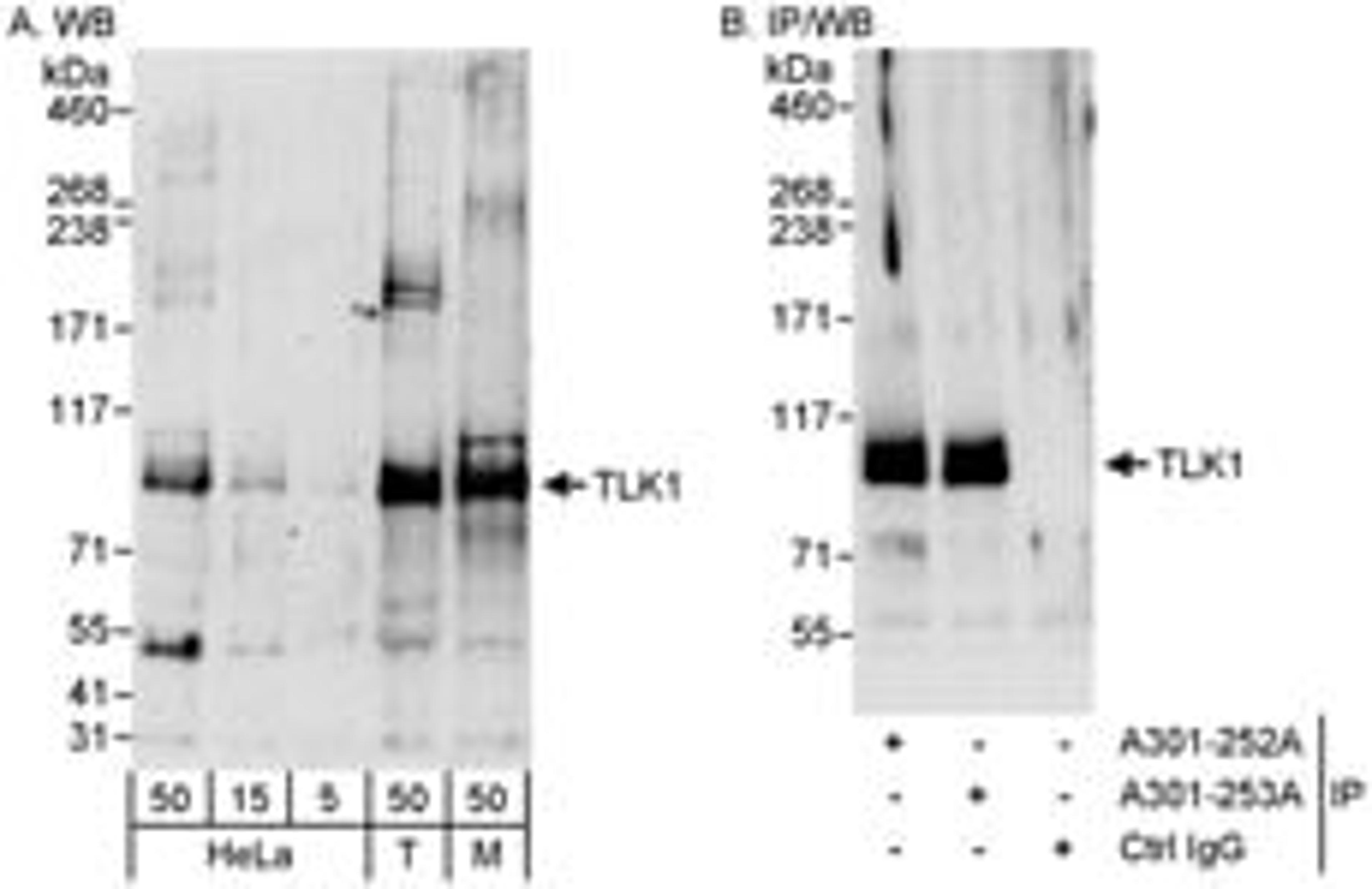 Detection of human and mouse TLK1 by western blot (h & m) and immunoprecipitation (h).