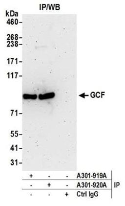 Detection of human GCF by western blot of immunoprecipitates.