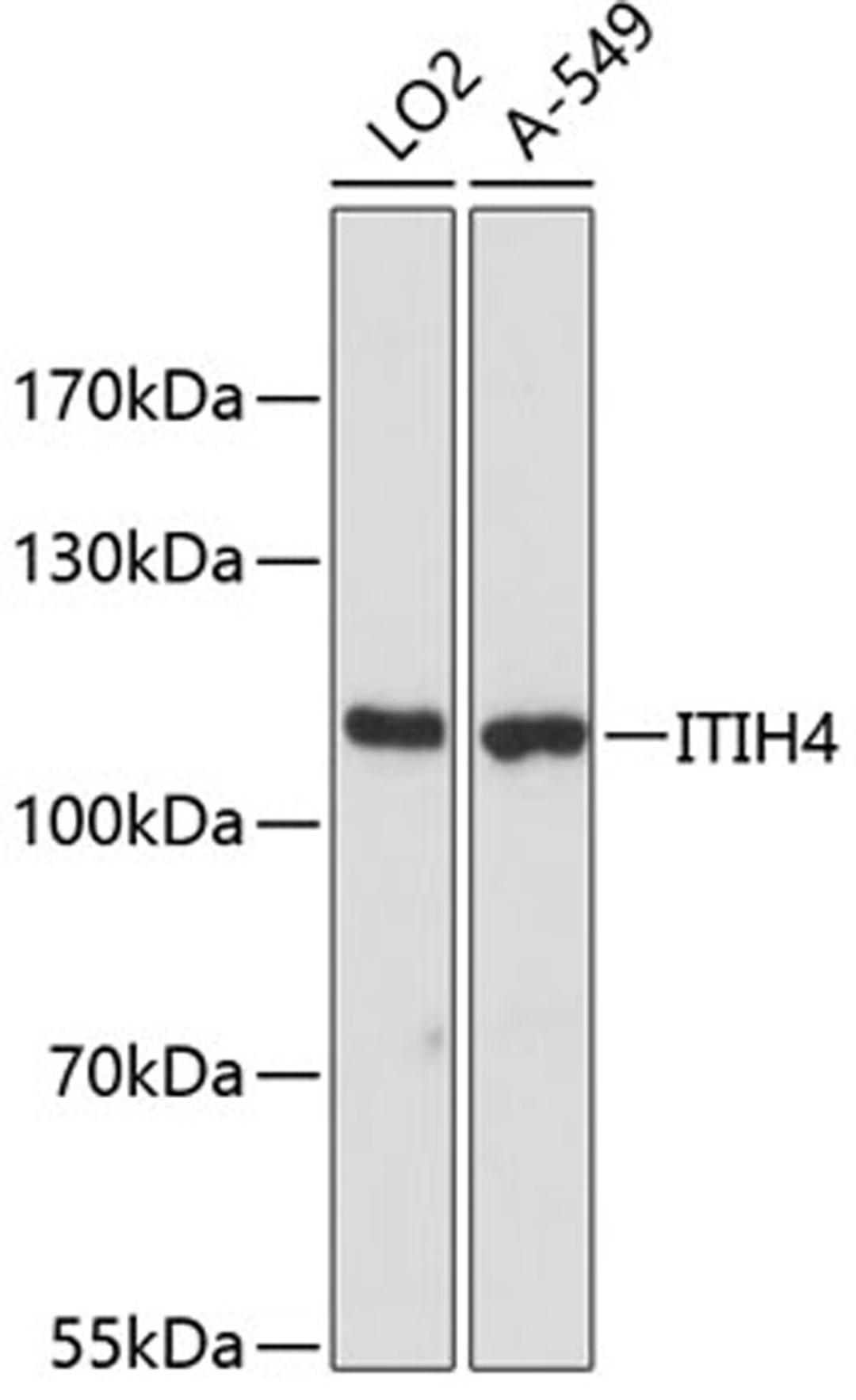 Western blot - ITIH4 antibody (A12807)