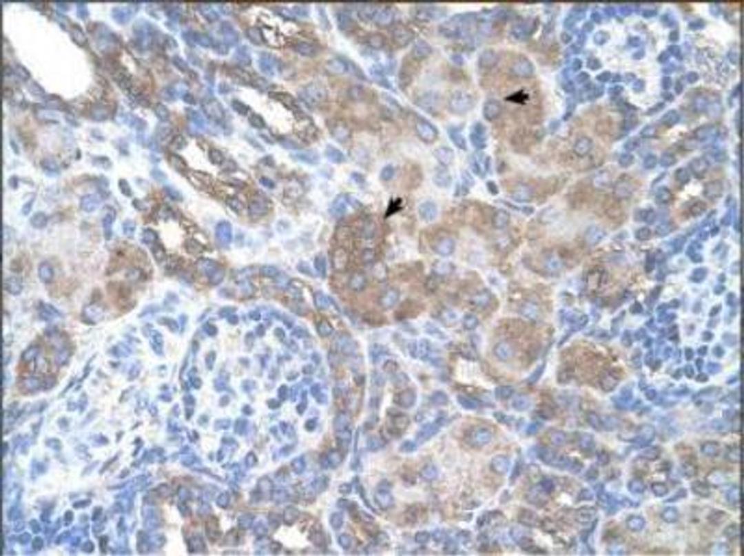 Immunohistochemistry-Paraffin: PMEL17/SILV Antibody [NBP1-69571] - Human Kidney: epithelial cells of renal tubule (indicated with arrows).