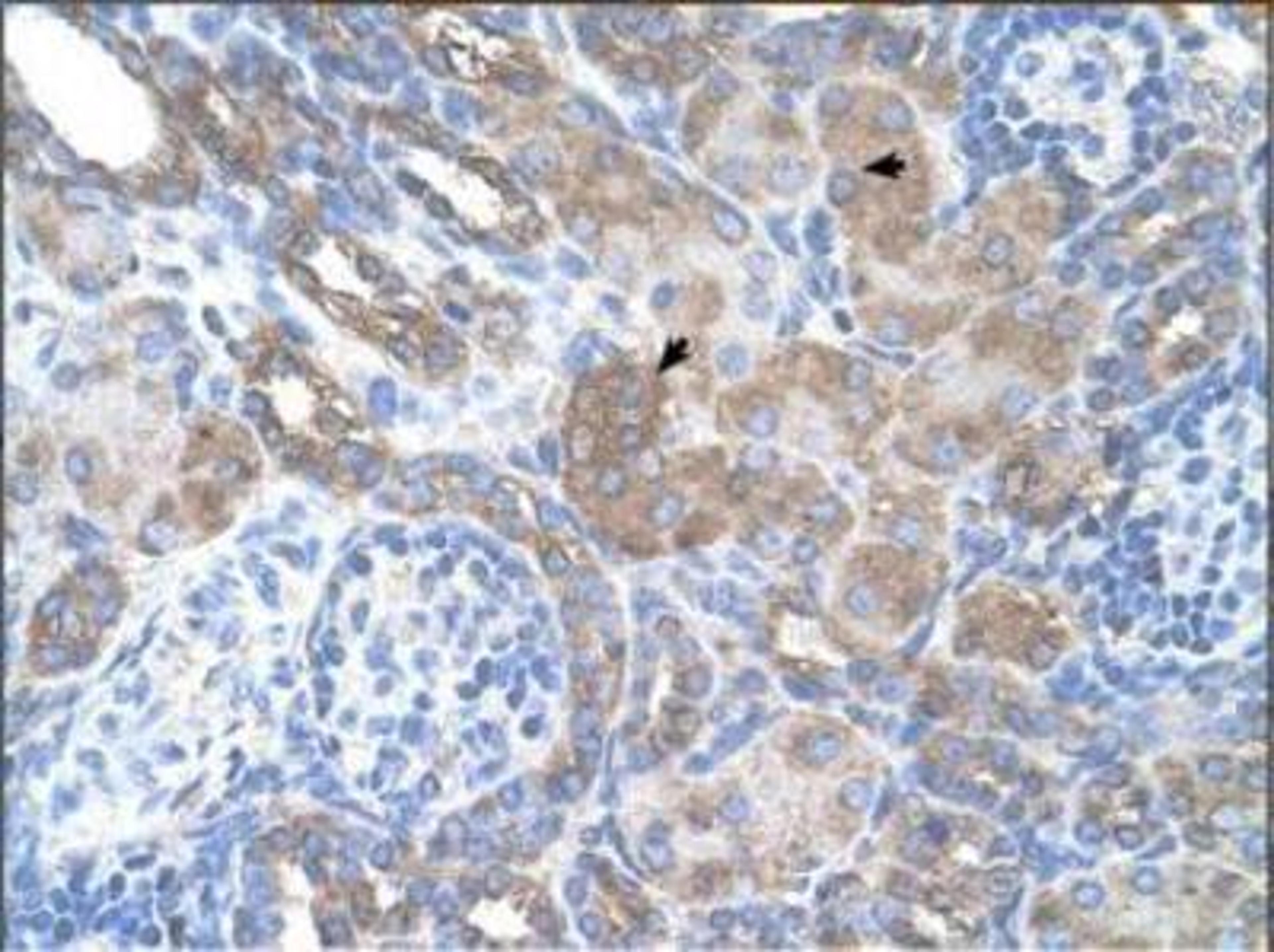 Immunohistochemistry-Paraffin: PMEL17/SILV Antibody [NBP1-69571] - Human Kidney: epithelial cells of renal tubule (indicated with arrows).