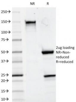 SDS-PAGE Analysis of Purified, BSA-Free CD20 Antibody (clone 93-1B3). Confirmation of Integrity and Purity of the Antibody.