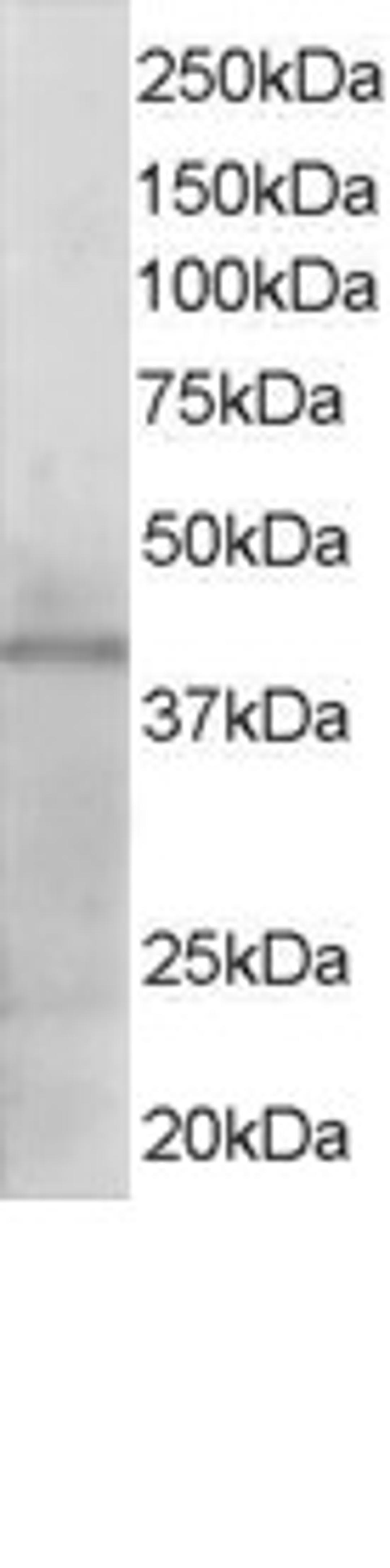 45-805 staining (1ug/ml) of Human Heart lysate (RIPA buffer, 35ug total protein per lane). Primary incubated for 1 hour. Detected by western blot using chemiluminescence.