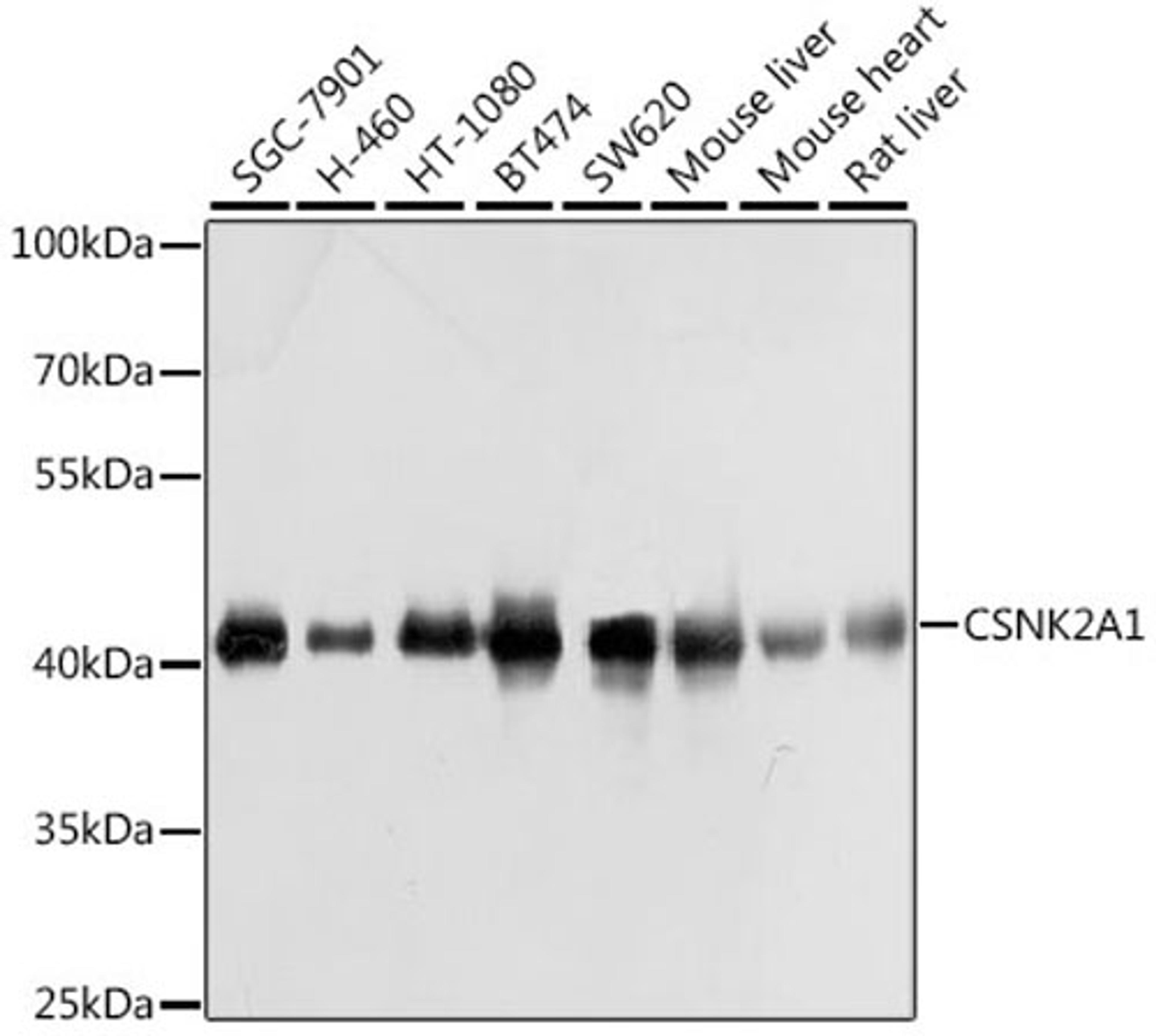 Western blot - CSNK2A1 antibody (A1014)