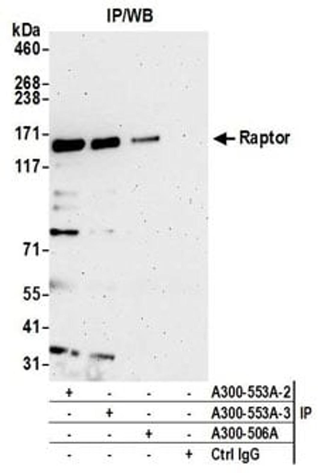 Detection of human Raptor by western blot of immunoprecipitates.