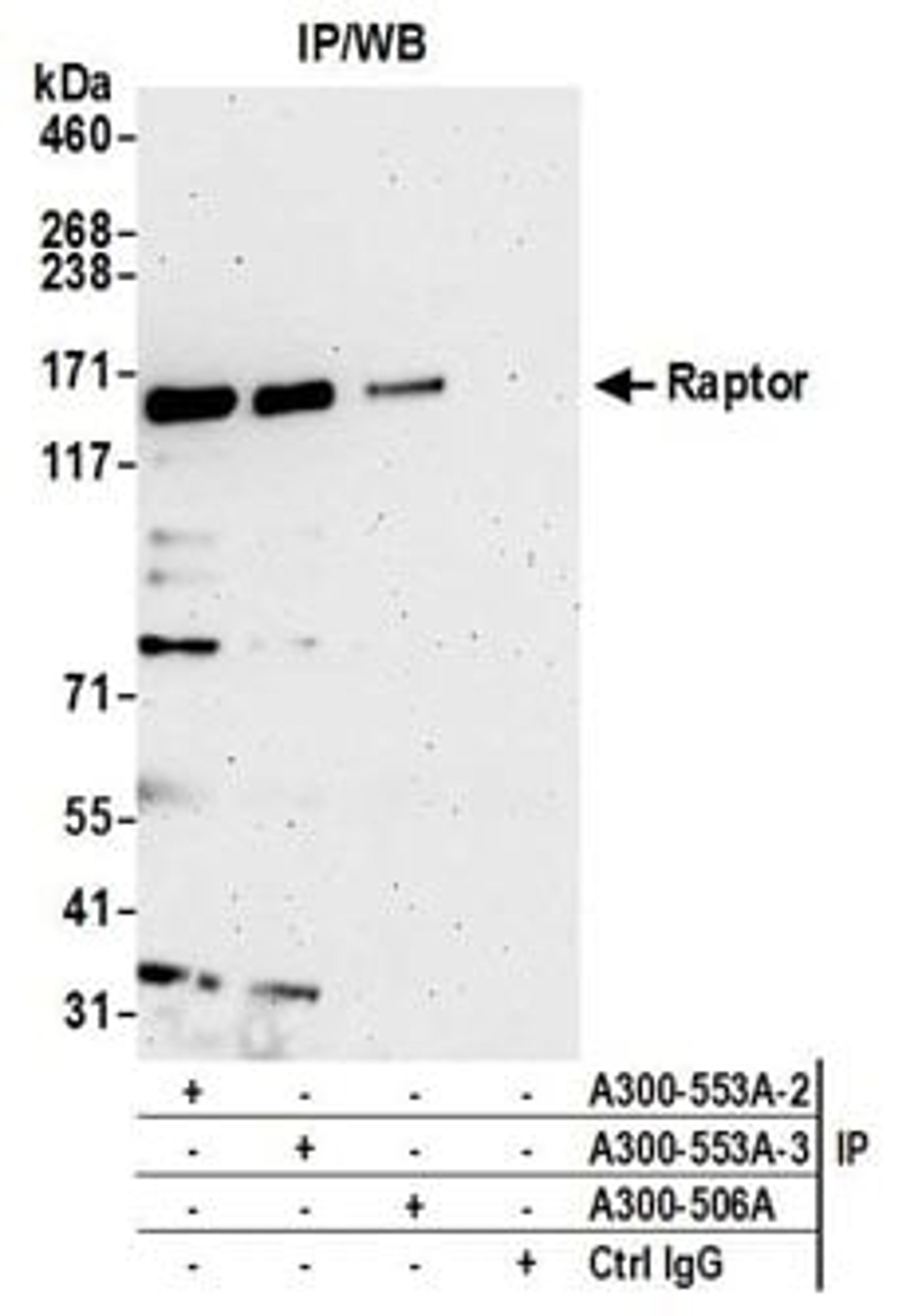 Detection of human Raptor by western blot of immunoprecipitates.