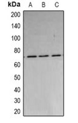 Western blot analysis of A549 (Lane1), MCF7 (Lane2), HepG2 (Lane3) whole cell lysates using PARN antibody