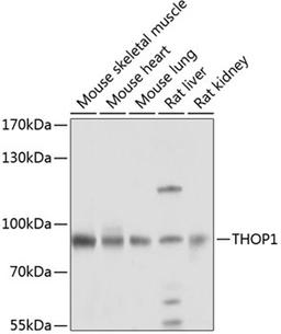 Western blot - THOP1 antibody (A8756)