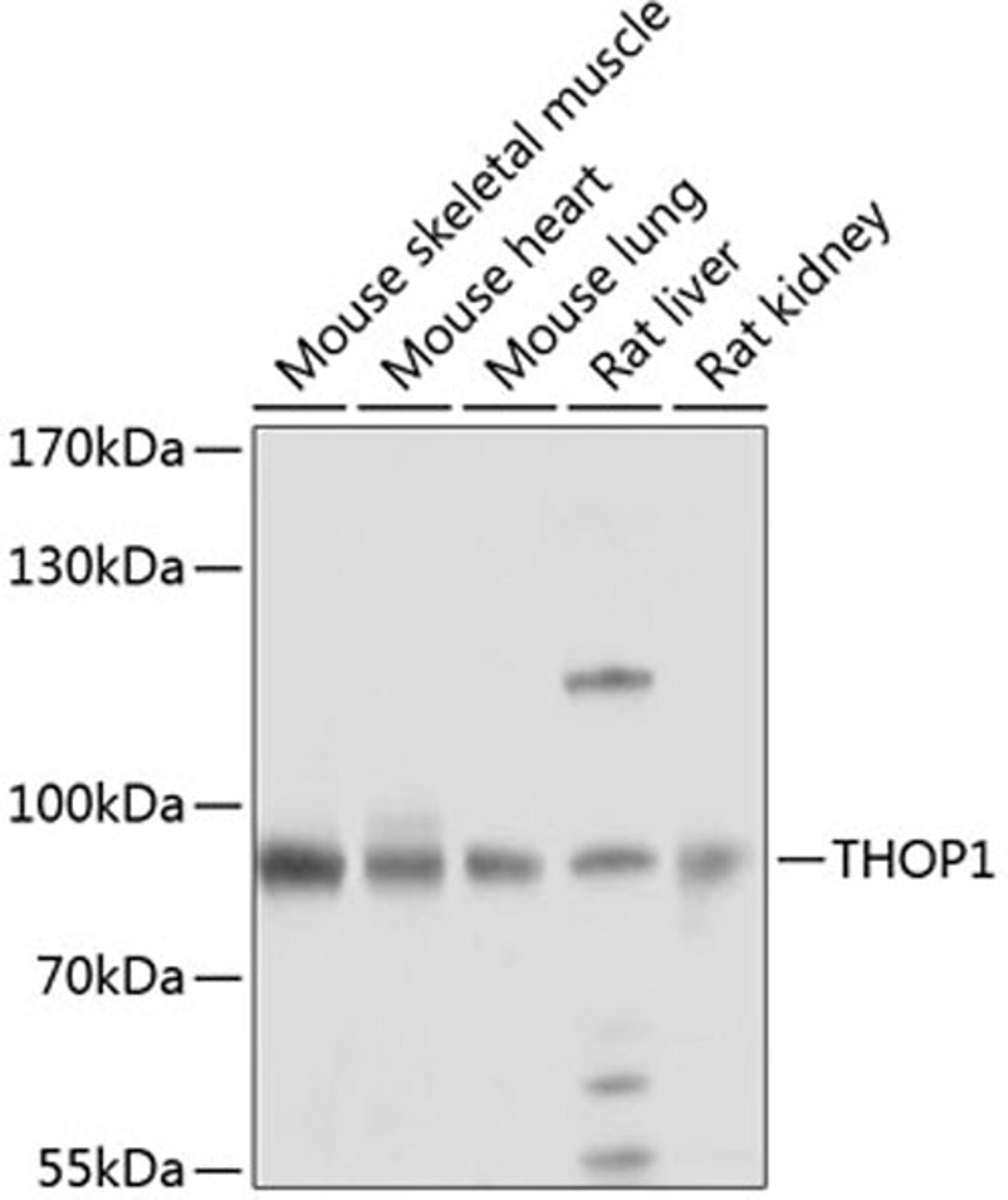 Western blot - THOP1 antibody (A8756)