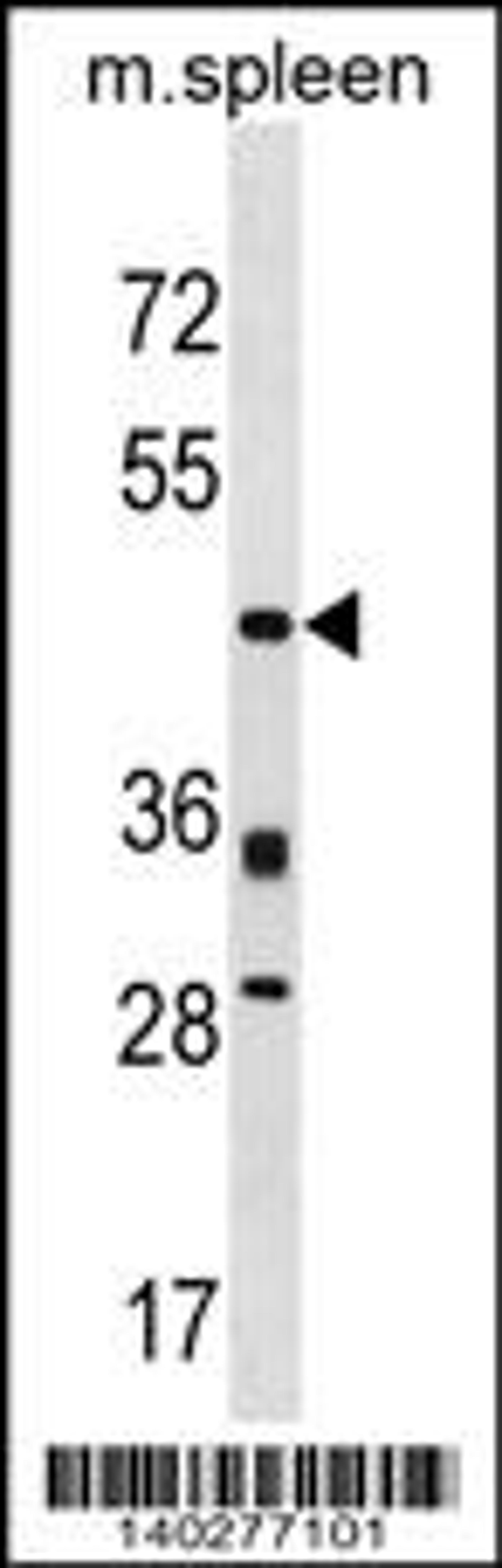 Western blot analysis in mouse spleen tissue lysates (35ug/lane).