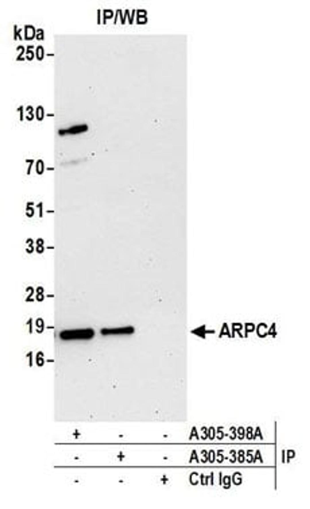 Detection of human ARPC4 by western blot of immunoprecipitates.