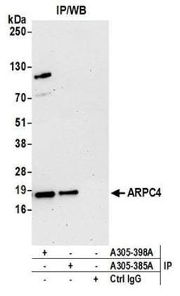 Detection of human ARPC4 by western blot of immunoprecipitates.