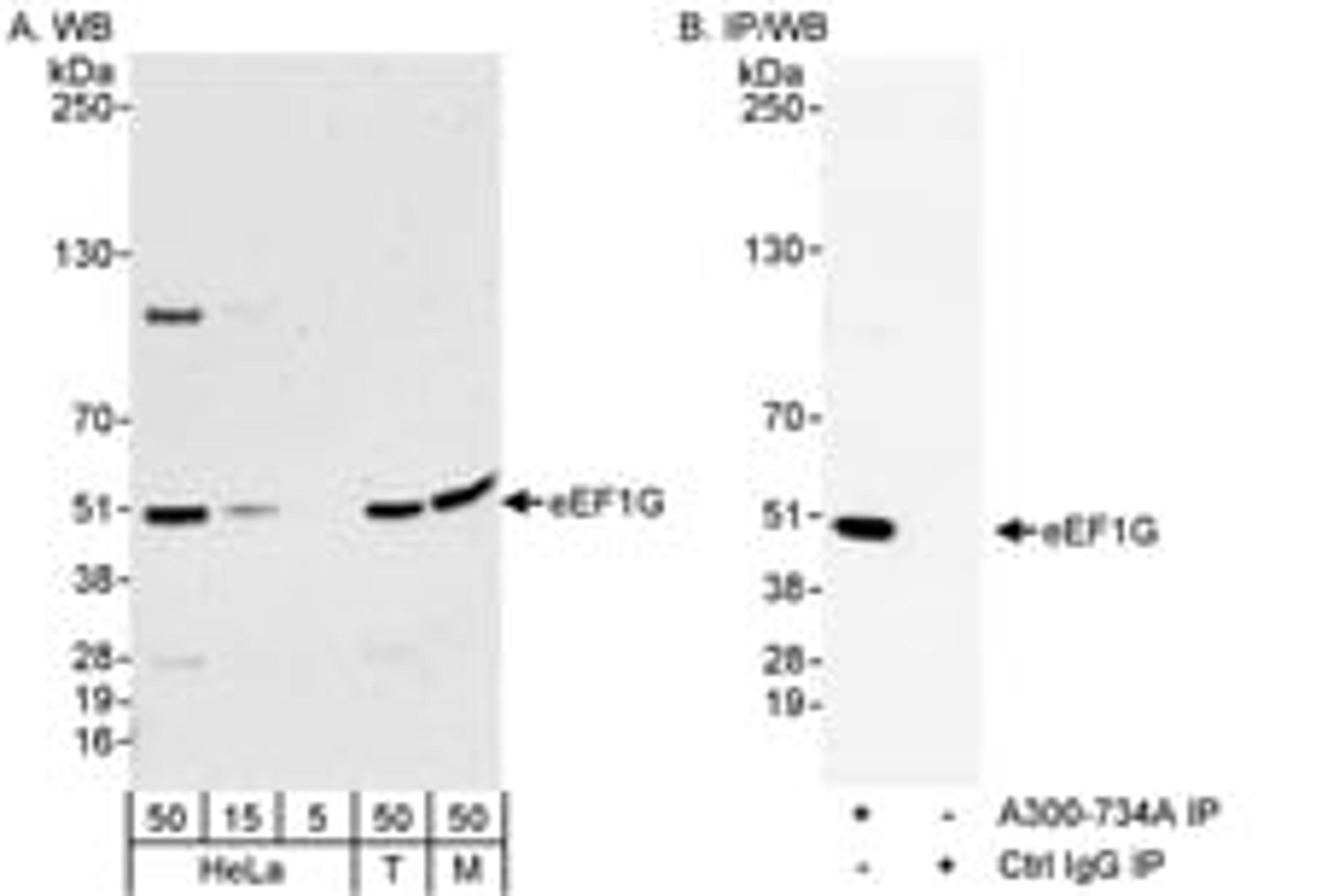 Detection of human and mouse eEF1G by western blot (h&m) and immunoprecipitation (h).