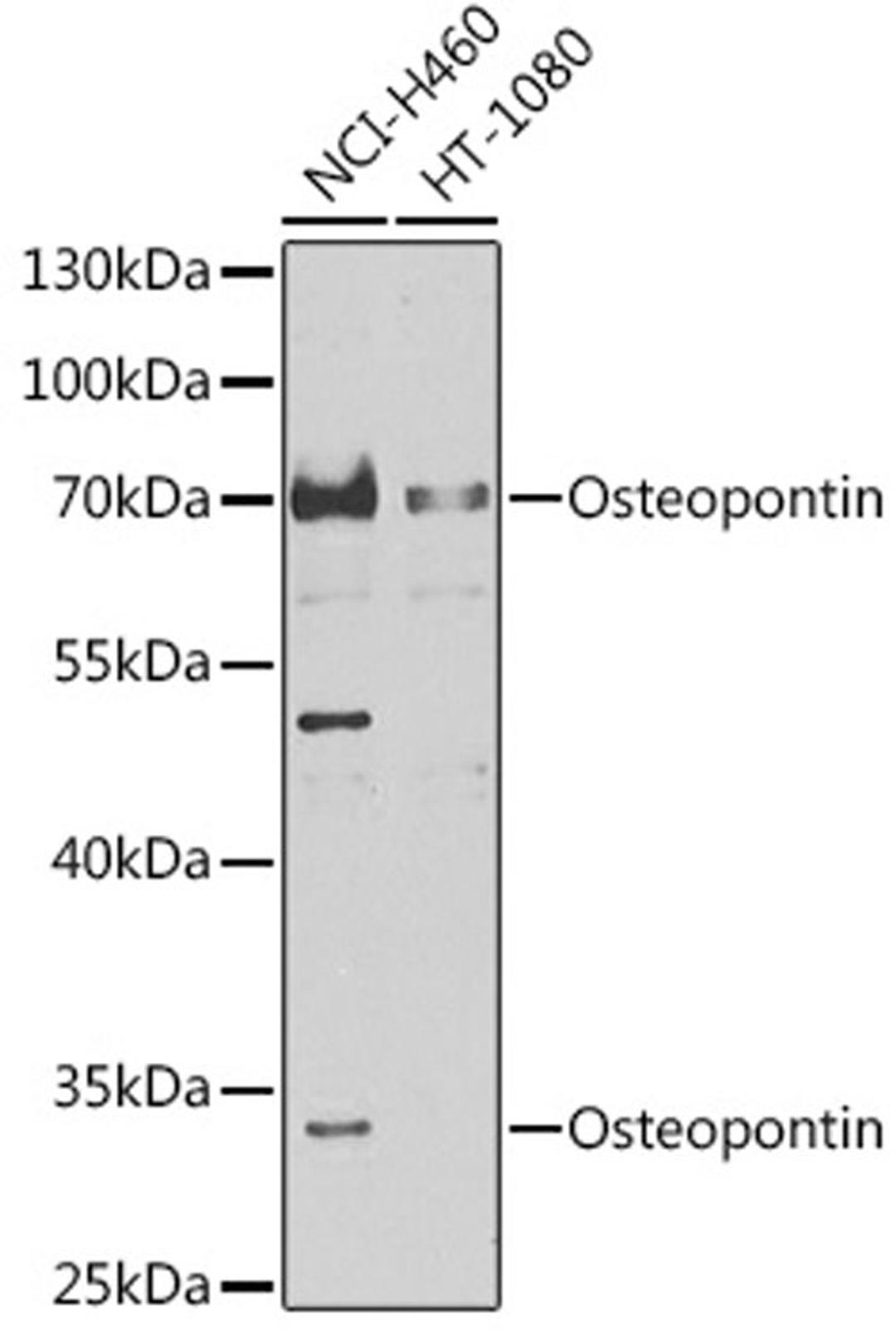 Western blot - Osteopontin antibody (A14062)