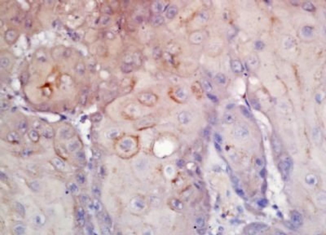 Immunohistochemical analysis of formalin-fixed paraffin embedded Human laryngeal tissue using CD276 antibody (dilution at 1:200)