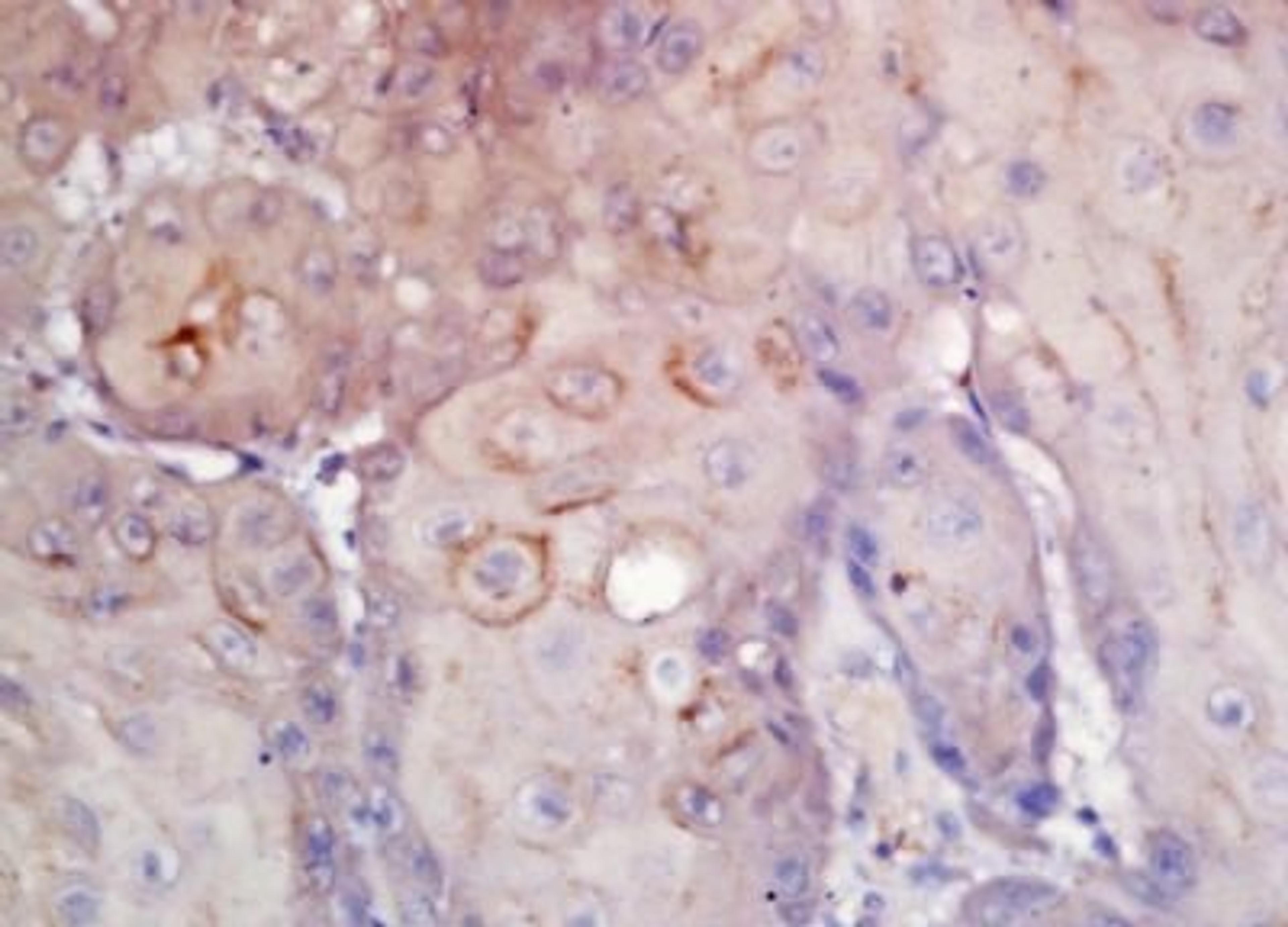 Immunohistochemical analysis of formalin-fixed paraffin embedded Human laryngeal tissue using CD276 antibody (dilution at 1:200)