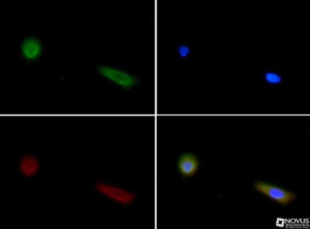 Immunocytochemistry/Immunofluorescence: Factor Inhibiting HIF-1 Antibody (162c) [NBP1-30333] - FIH (162C) antibody was tested in A431 cells with FITC (green). Nuclei and alpha-tubulin were counterstained with Dapi (blue) and Dylight 550 (red).