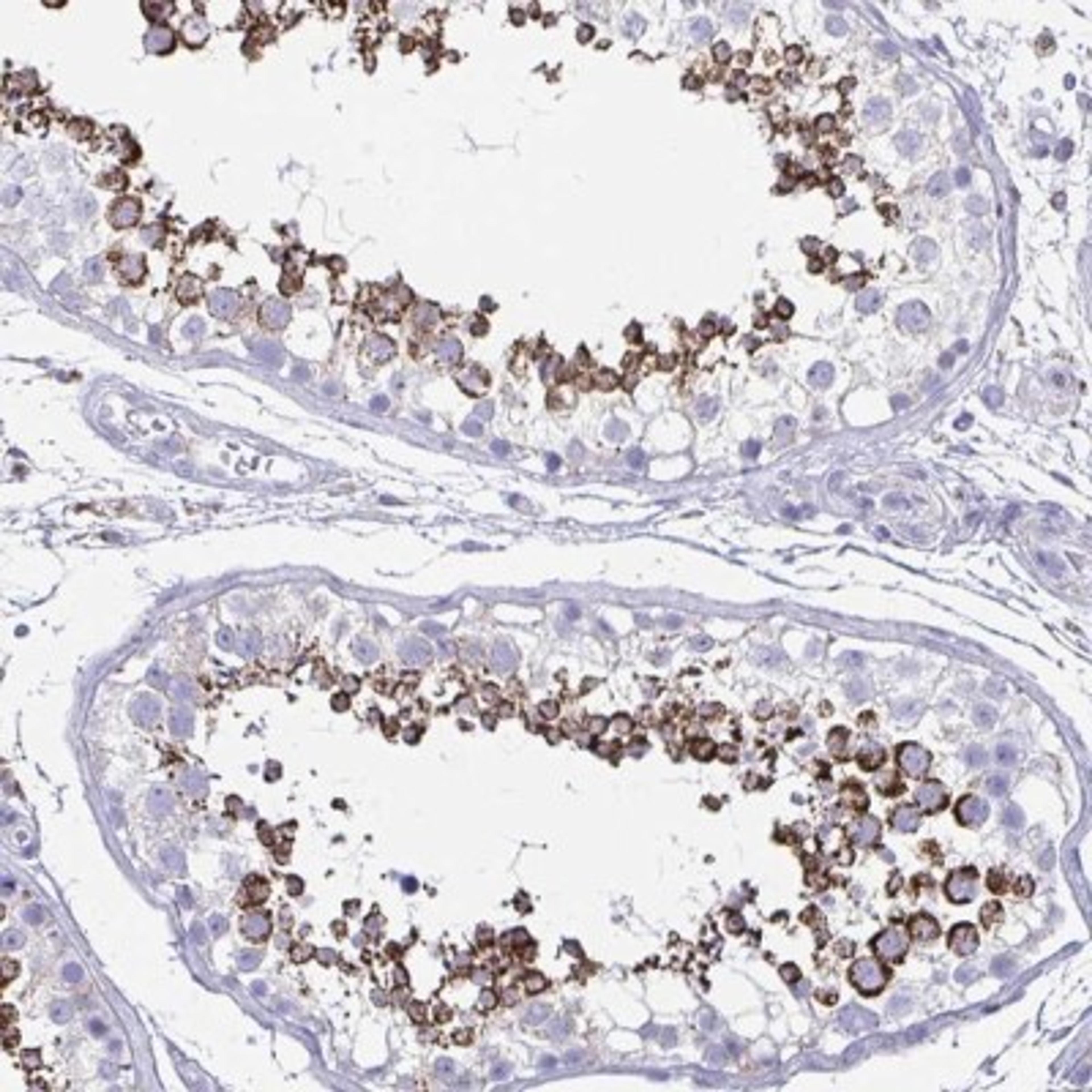 Immunohistochemistry: HRASLS2 Antibody [NBP2-31737] - Staining of human testis shows strong cytoplasmic positivity in subset of cells in seminiferous ducts.