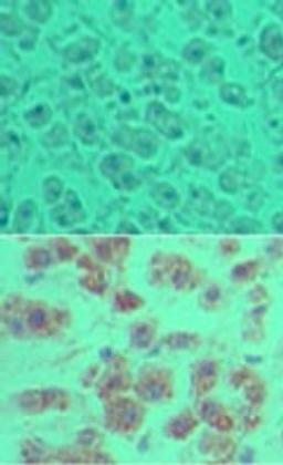 Immunohistochemistry-Paraffin: OTUD5 Antibody [NBP2-24634] - Analysis of DUBA in formalin-fixed, paraffin-embedded human liver tissue using an isotype control (top) and this antibody (bottom) at 5 ug/ml.