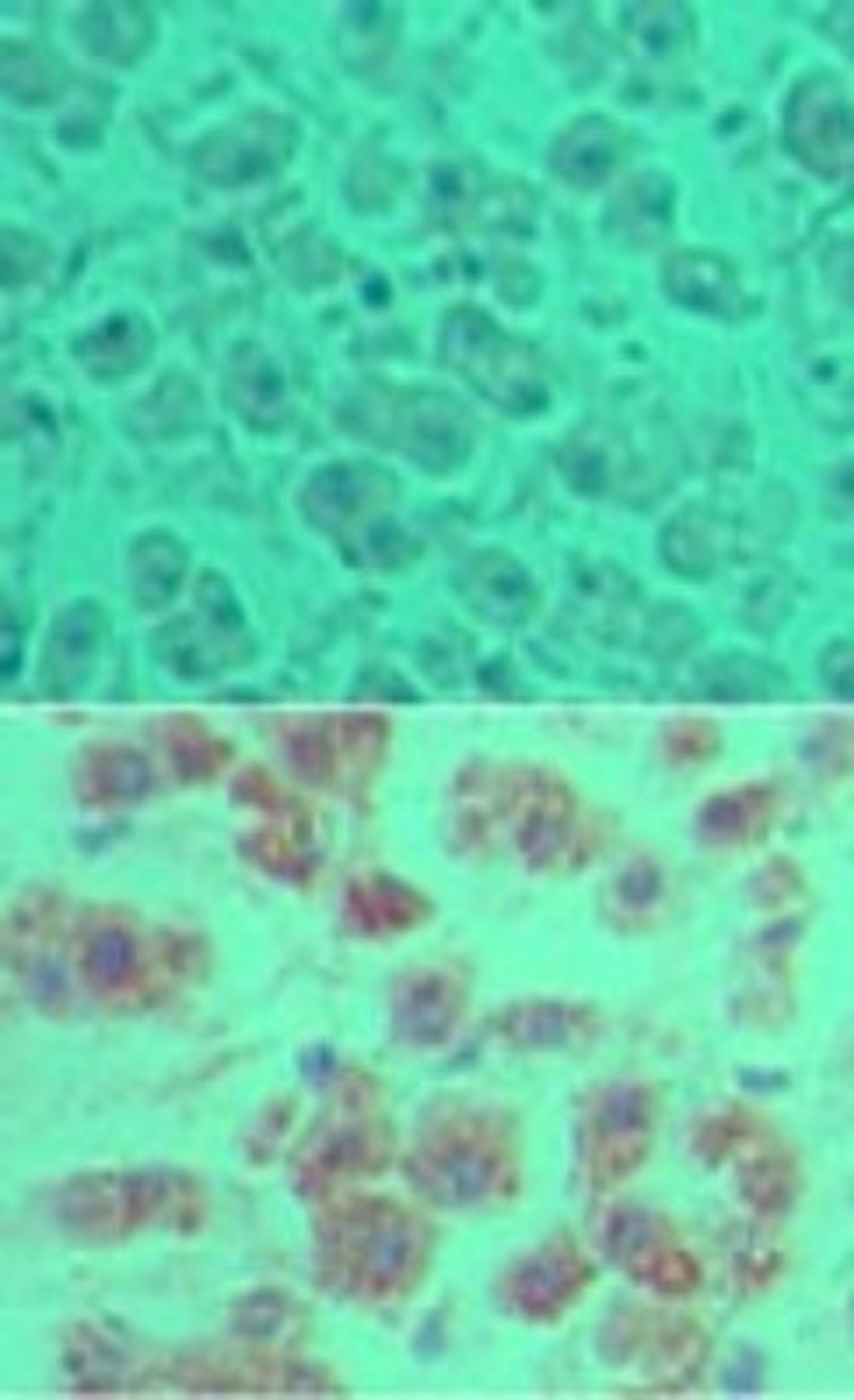 Immunohistochemistry-Paraffin: OTUD5 Antibody [NBP2-24634] - Analysis of DUBA in formalin-fixed, paraffin-embedded human liver tissue using an isotype control (top) and this antibody (bottom) at 5 ug/ml.