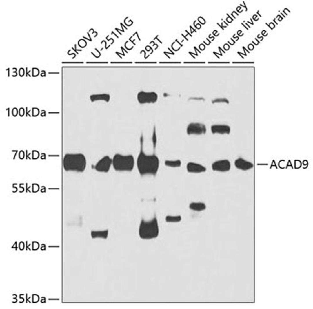 Western blot - ACAD9 antibody (A7798)