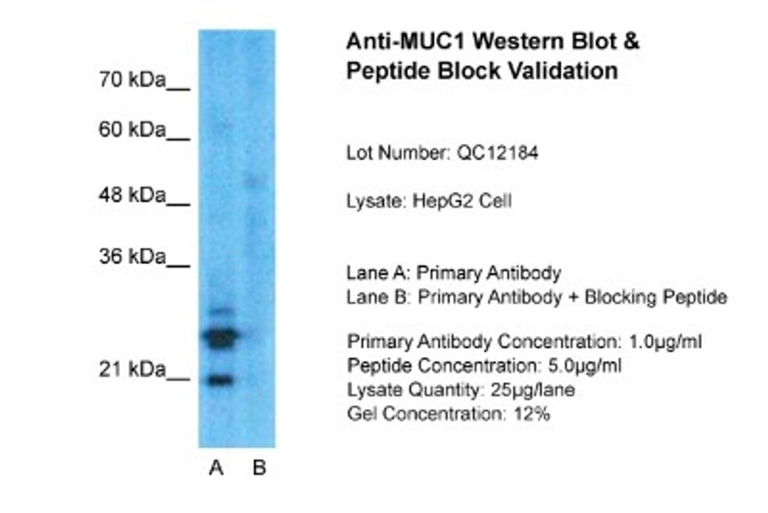 Western Blot: MUC1 Antibody [NBP1-60046] - Sample Tissue: HepG2, Lane A: Primary Antibody, Lane B: Primary Antibody + Blocking Peptide, Primary Antibody Concentration: 1ug/ml, Peptide Concentration: 5ug/ml, Lysate Quantity: 25ug/lane/lane, Gel Concentration: 0.12