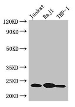 Western Blot. Positive WB detected in: Jurkat whole cell lysate, Raji whole cell lysate, THP-1 whole cell lysate. All lanes: ARHGDIB antibody at 3µg/ml. Secondary. Goat polyclonal to rabbit IgG at 1/50000 dilution. Predicted band size: 23 kDa. Observed band size: 23 kDa