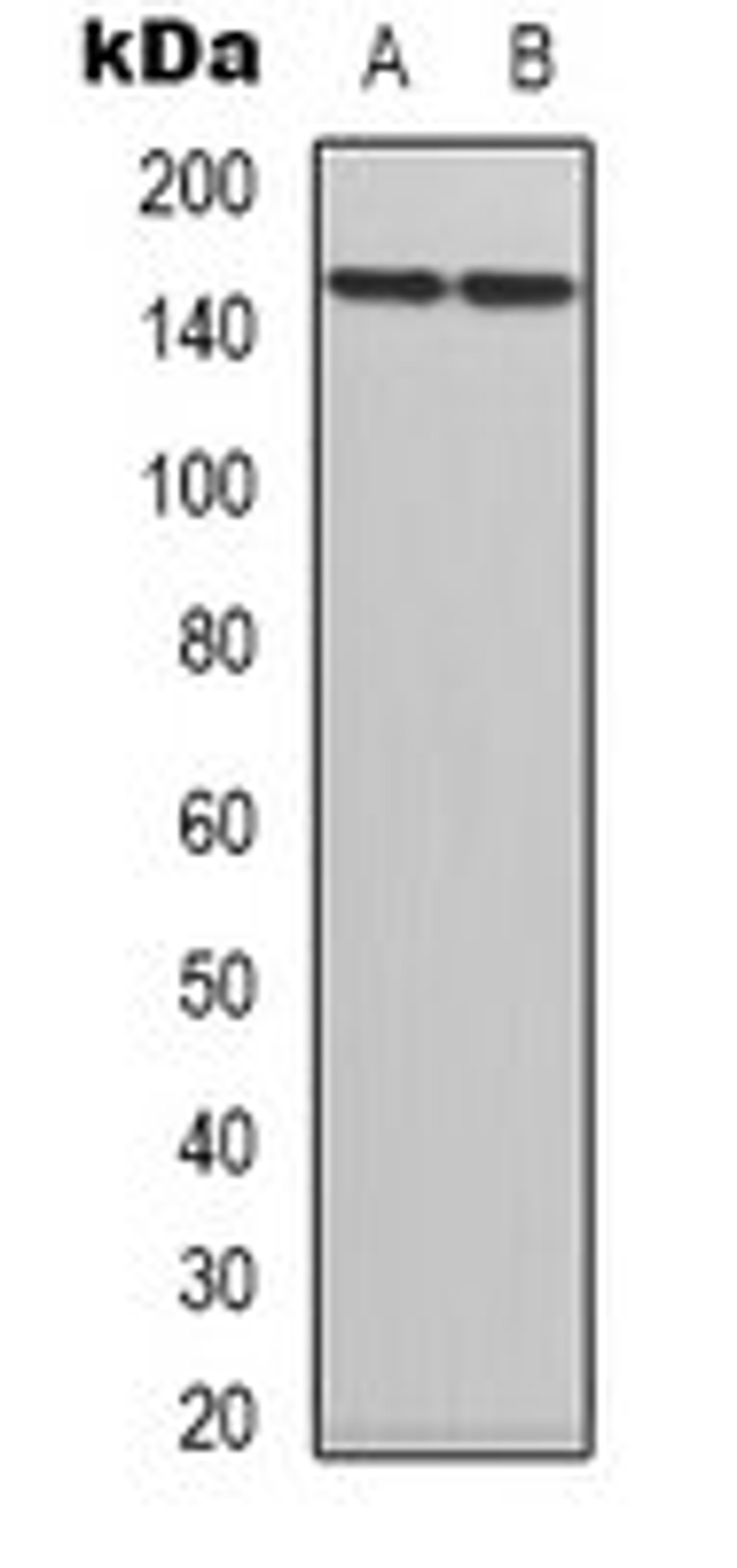 Western blot analysis of HepG2 (Lane 1), HL60 (Lane 2) whole cell lysates using TRK B antibody