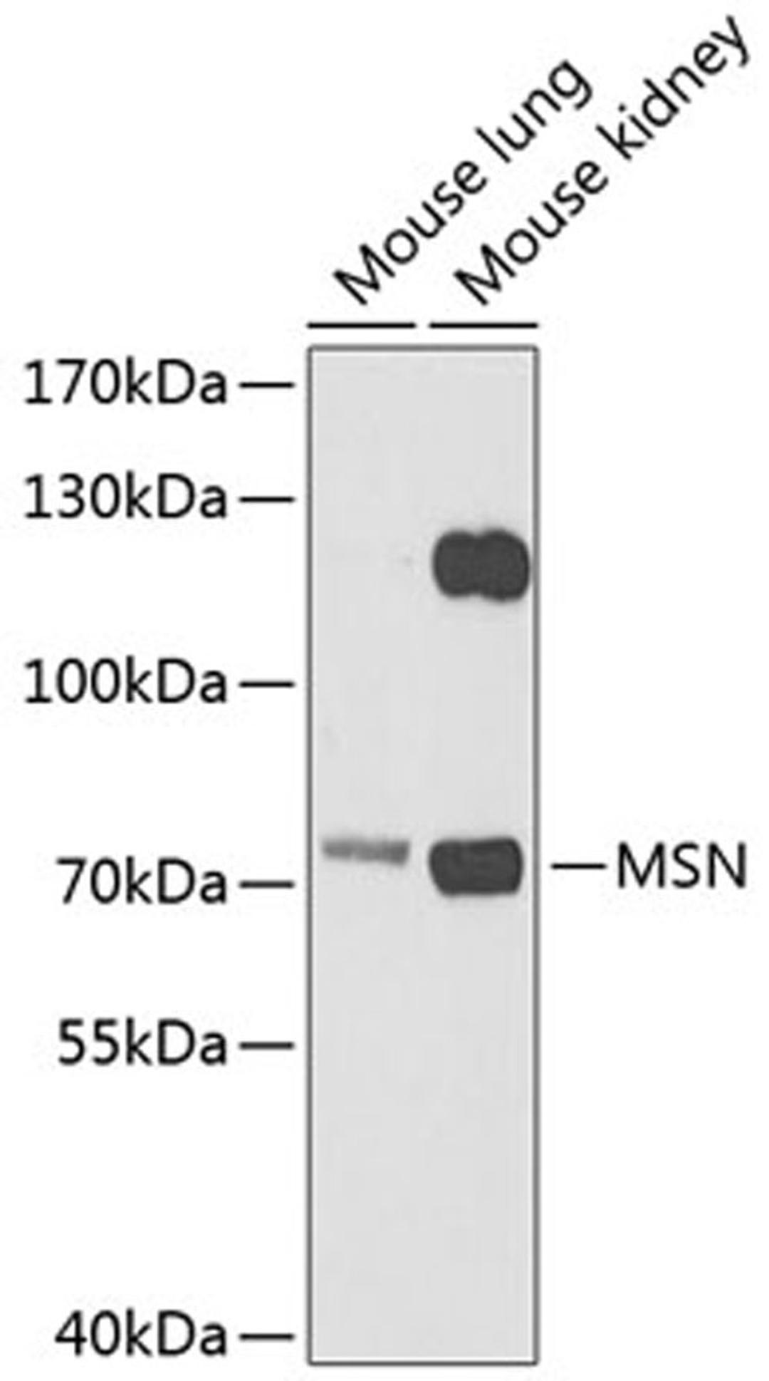 Western blot - MSN antibody (A12463)