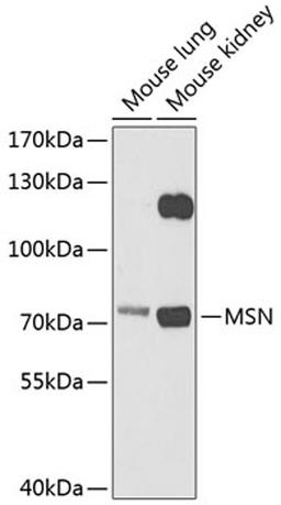 Western blot - MSN antibody (A12463)