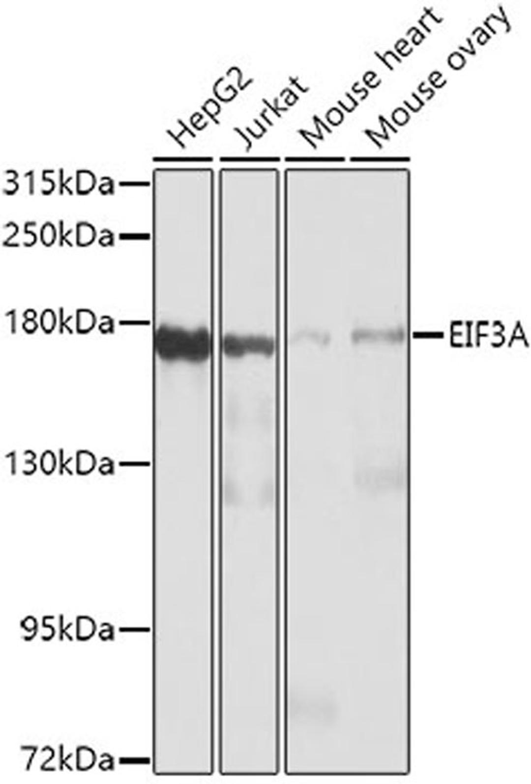 Western blot - EIF3A antibody (A0573)