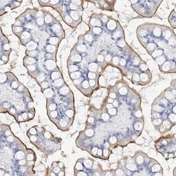 Immunohistochemistry-Paraffin: MUC17 Antibody [NBP1-91013] - Staining of human small intestine shows moderate luminal membrane positivity in glandular cells.