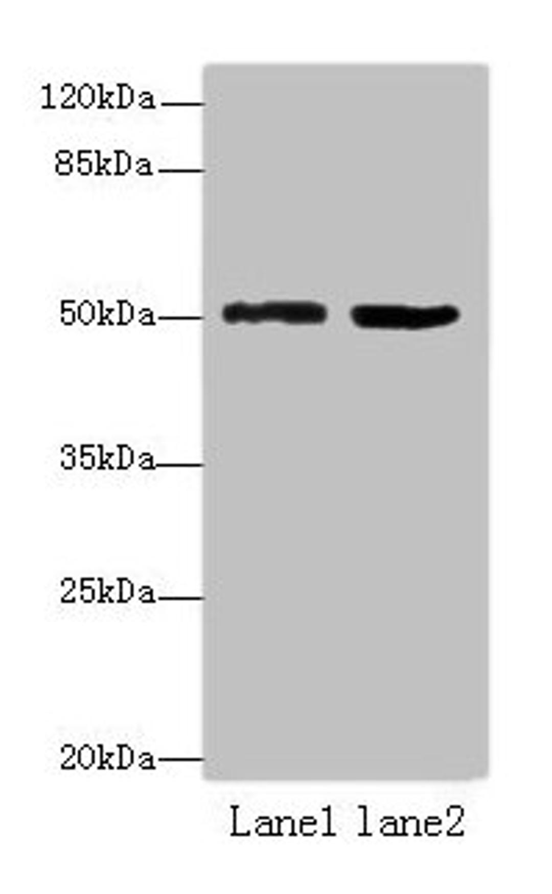 Western blot. All lanes: ZBTB32 antibody at 4ug/ml. Lane 1: Mouse brain tissue. Lane 2: Jurkat whole cell lysate. Secondary. Goat polyclonal to rabbit IgG at 1/10000 dilution. Predicted band size: 53 kDa. Observed band size: 53 kDa. 