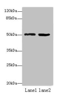 Western blot. All lanes: ZBTB32 antibody at 4ug/ml. Lane 1: Mouse brain tissue. Lane 2: Jurkat whole cell lysate. Secondary. Goat polyclonal to rabbit IgG at 1/10000 dilution. Predicted band size: 53 kDa. Observed band size: 53 kDa. 