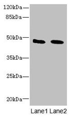 Western blot. All lanes: IGSF11 antibody at 1.5µg/ml. Lane 1: Mouse brain tissue. Lane 2: Jurkat whole cell lysate. Secondary. Goat polyclonal to rabbit IgG at 1/10000 dilution. Predicted band size: 47, 44 kDa. Observed band size: 47 kDa