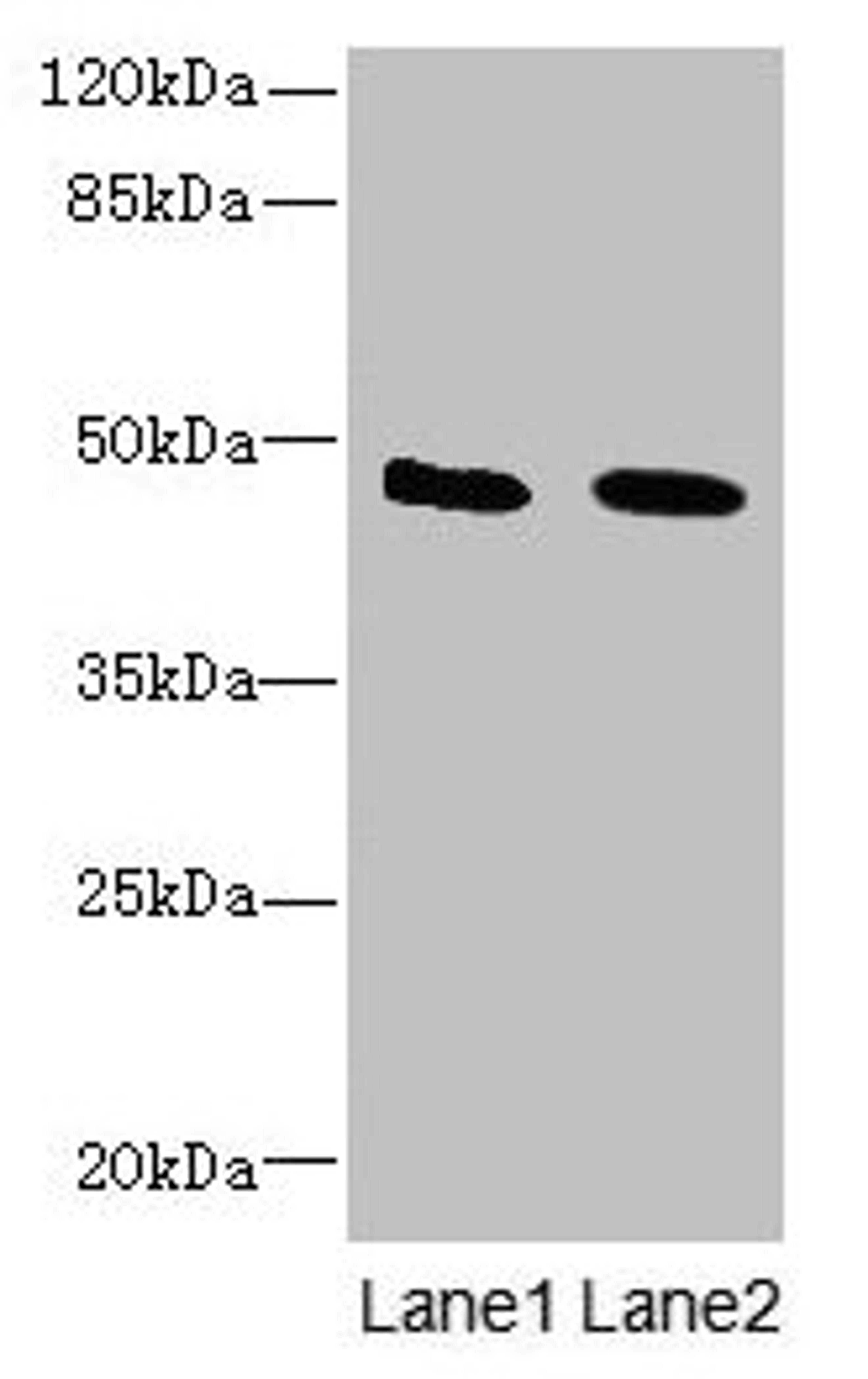 Western blot. All lanes: IGSF11 antibody at 1.5µg/ml. Lane 1: Mouse brain tissue. Lane 2: Jurkat whole cell lysate. Secondary. Goat polyclonal to rabbit IgG at 1/10000 dilution. Predicted band size: 47, 44 kDa. Observed band size: 47 kDa