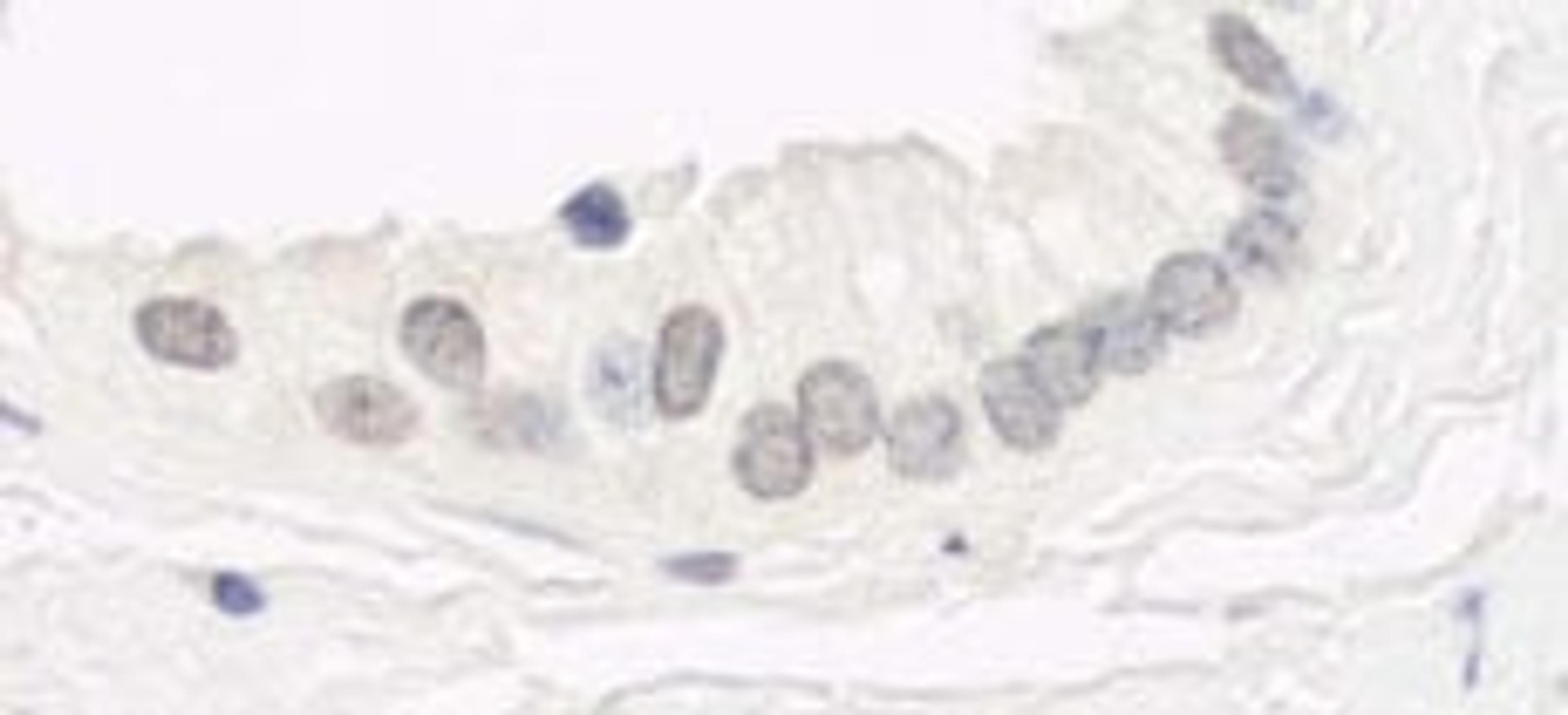 Detection of human Haspin by immunohistochemistry.