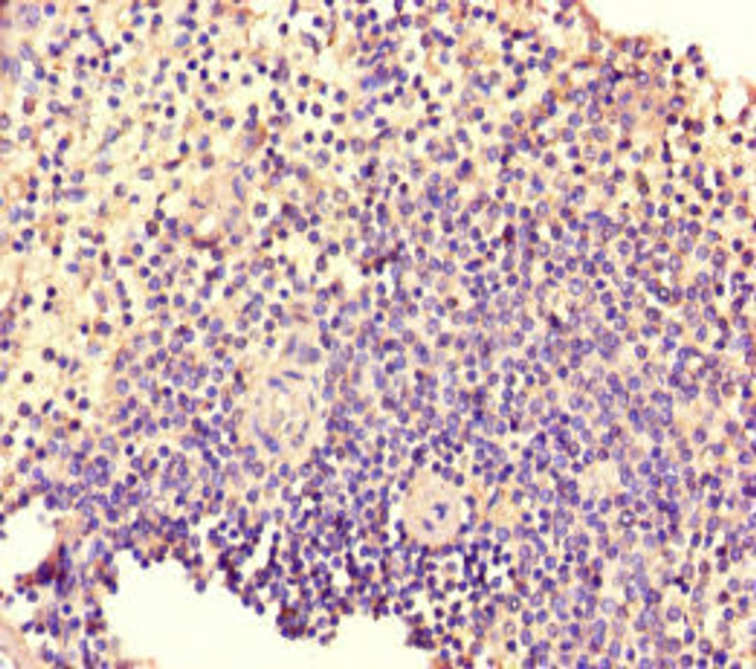 Immunohistochemistry of paraffin-embedded human spleen tissue using CSB-PA614387LA01HU at dilution of 1:100