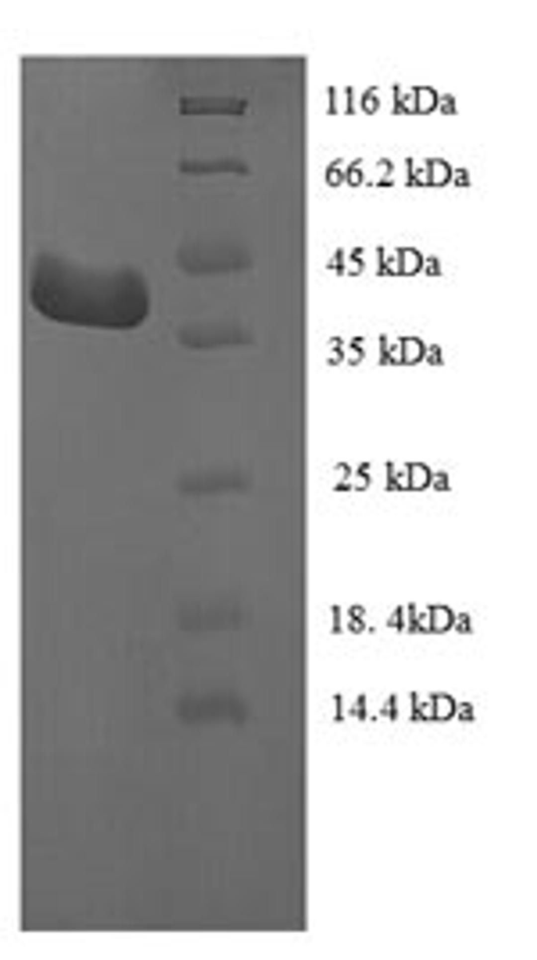 (Tris-Glycine gel) Discontinuous SDS-PAGE (reduced) with 5% enrichment gel and 15% separation gel.