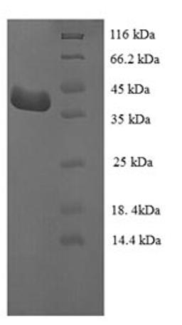 (Tris-Glycine gel) Discontinuous SDS-PAGE (reduced) with 5% enrichment gel and 15% separation gel.