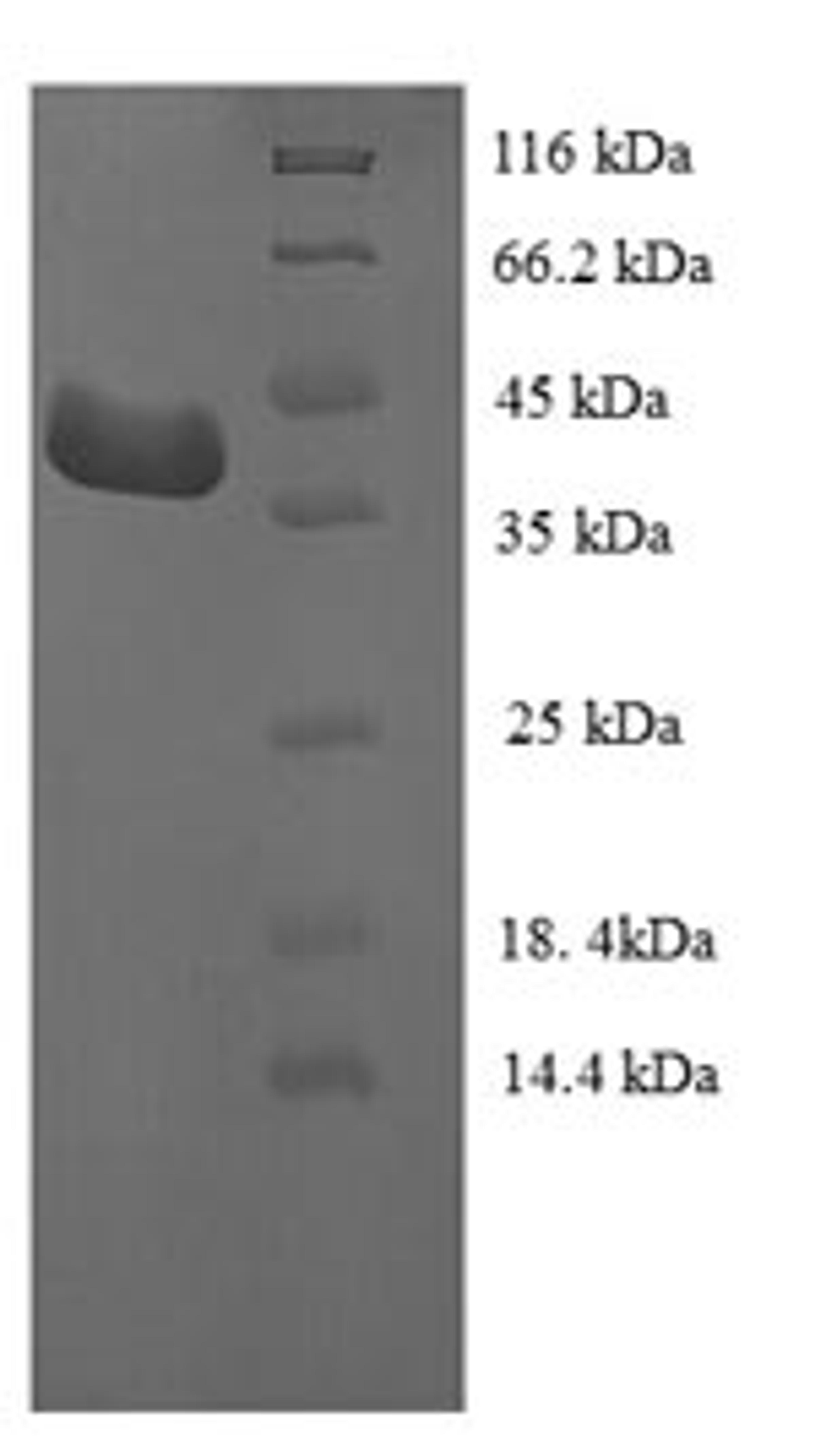 (Tris-Glycine gel) Discontinuous SDS-PAGE (reduced) with 5% enrichment gel and 15% separation gel.