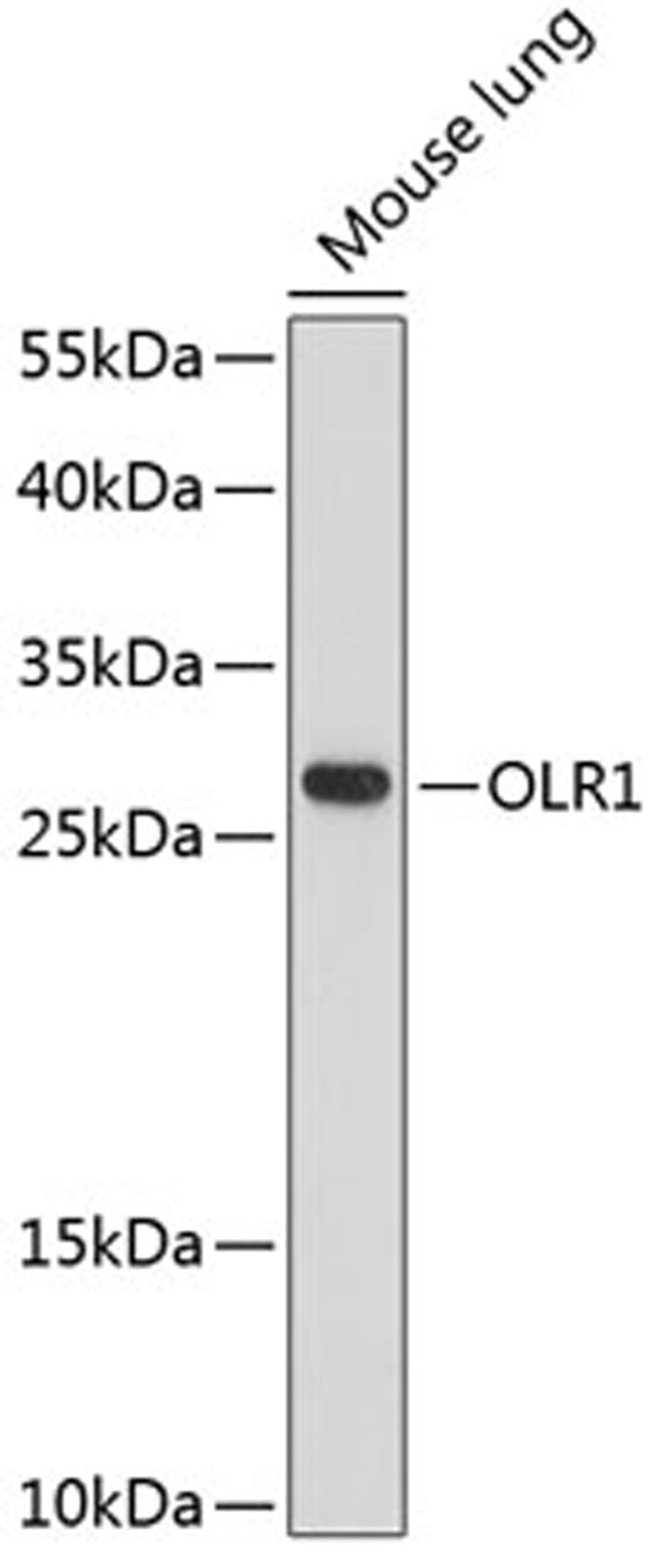 Western blot - OLR1 antibody (A12060)