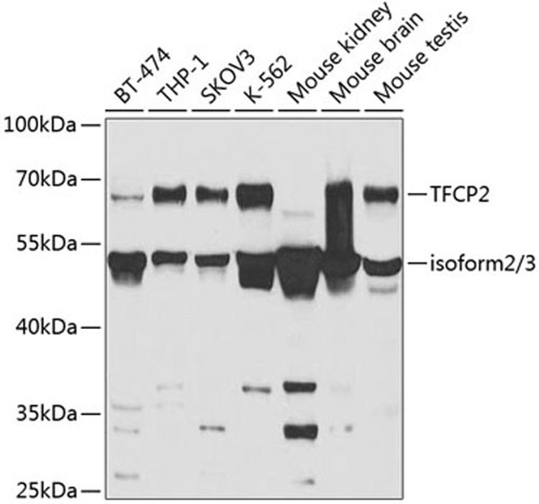 Western blot - TFCP2 antibody (A5555)