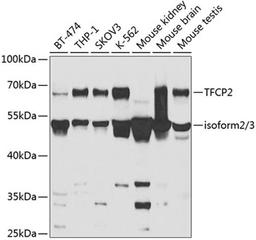 Western blot - TFCP2 antibody (A5555)